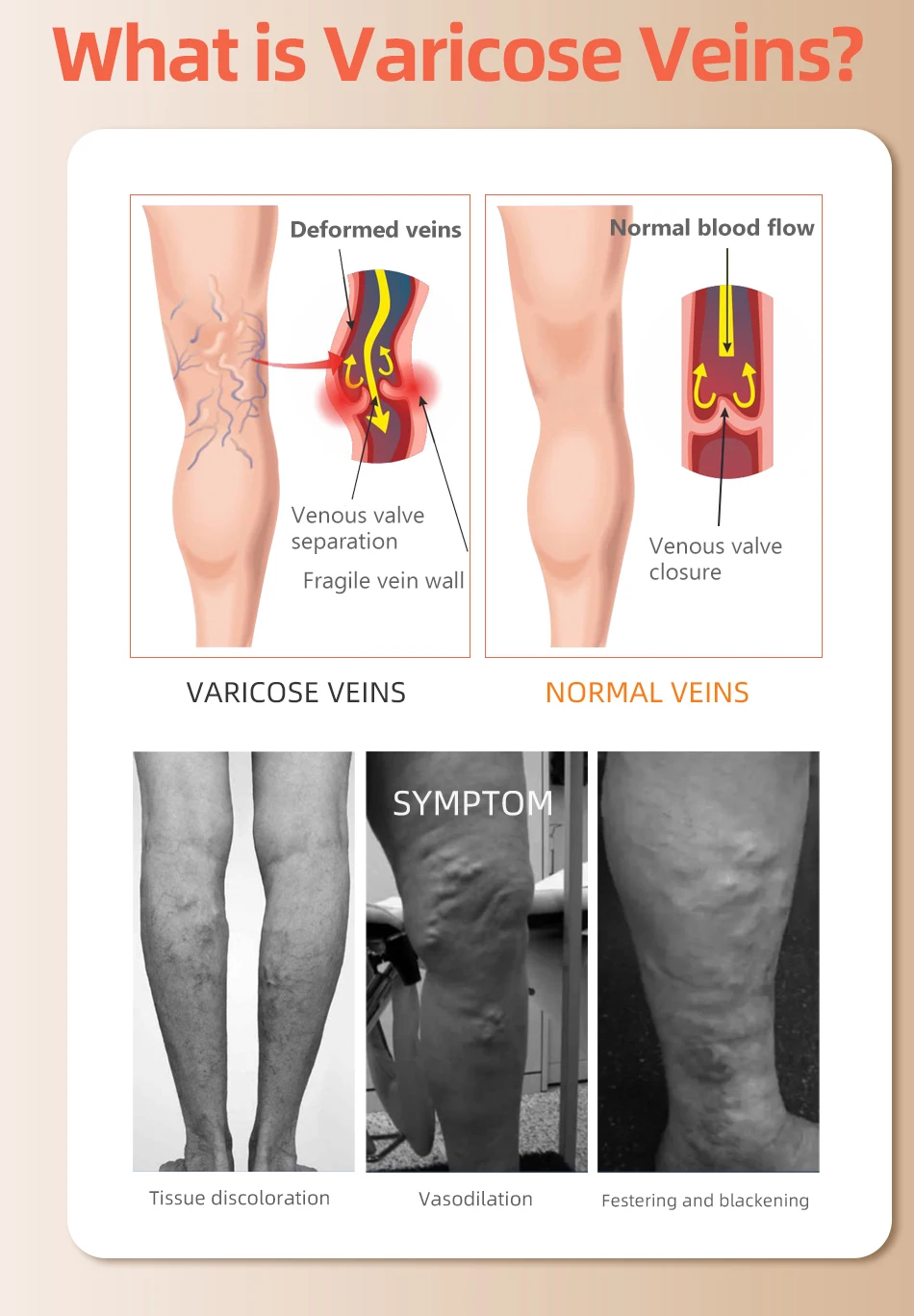 30-40 MmHg sobre la rodilla pu - Compression Sock Medical reseña y precio